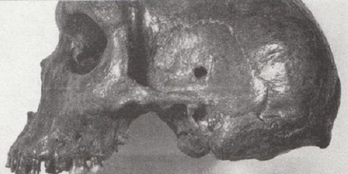 射殺されたネアンンデアタールジンの頭蓋骨